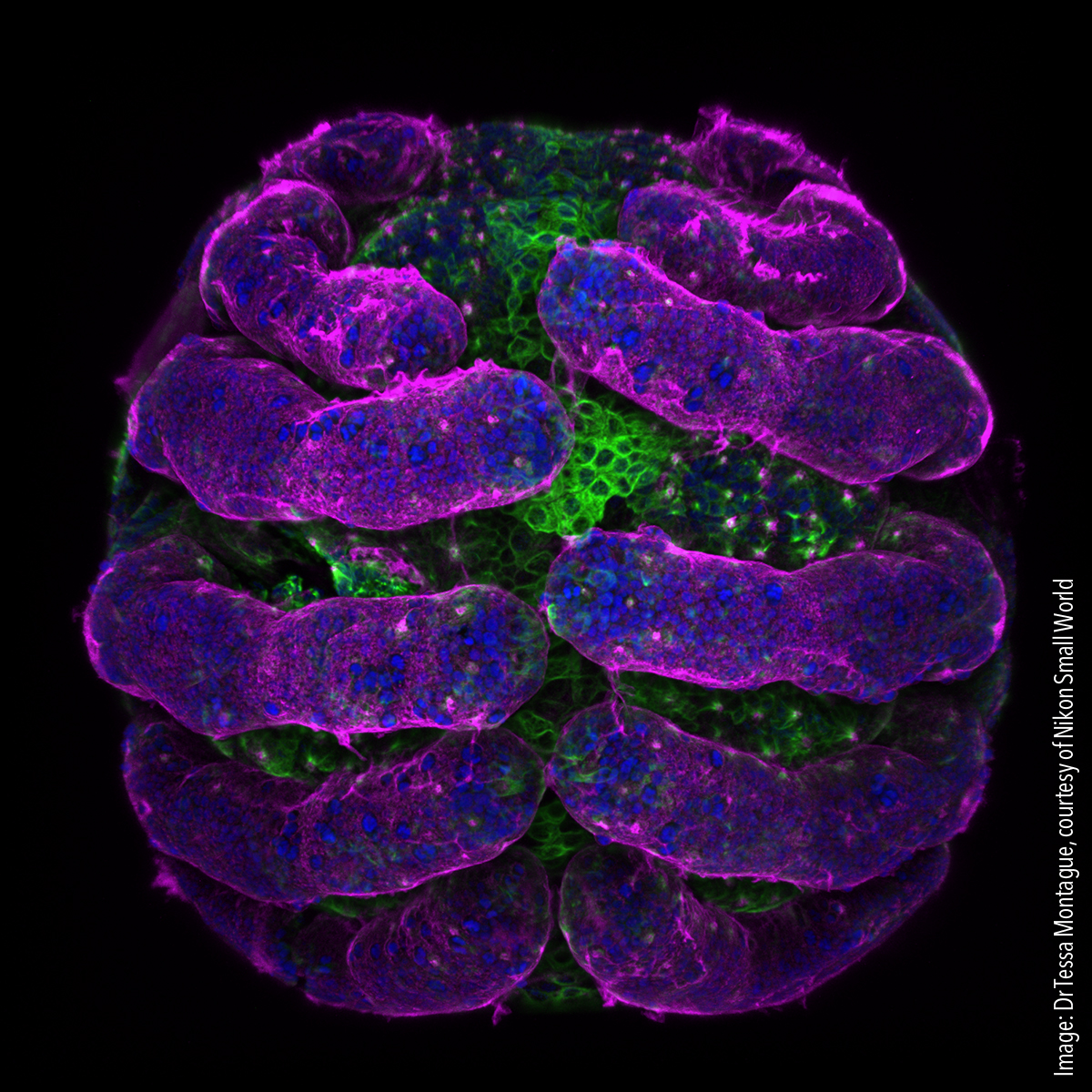 Parasteatoda tepidariorum (spider embryo) stained for embryo surface (pink), nuclei (blue) and microtubules (green). Confocal 20x (objective lens magnification)